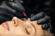 Abonnement behandeling A
