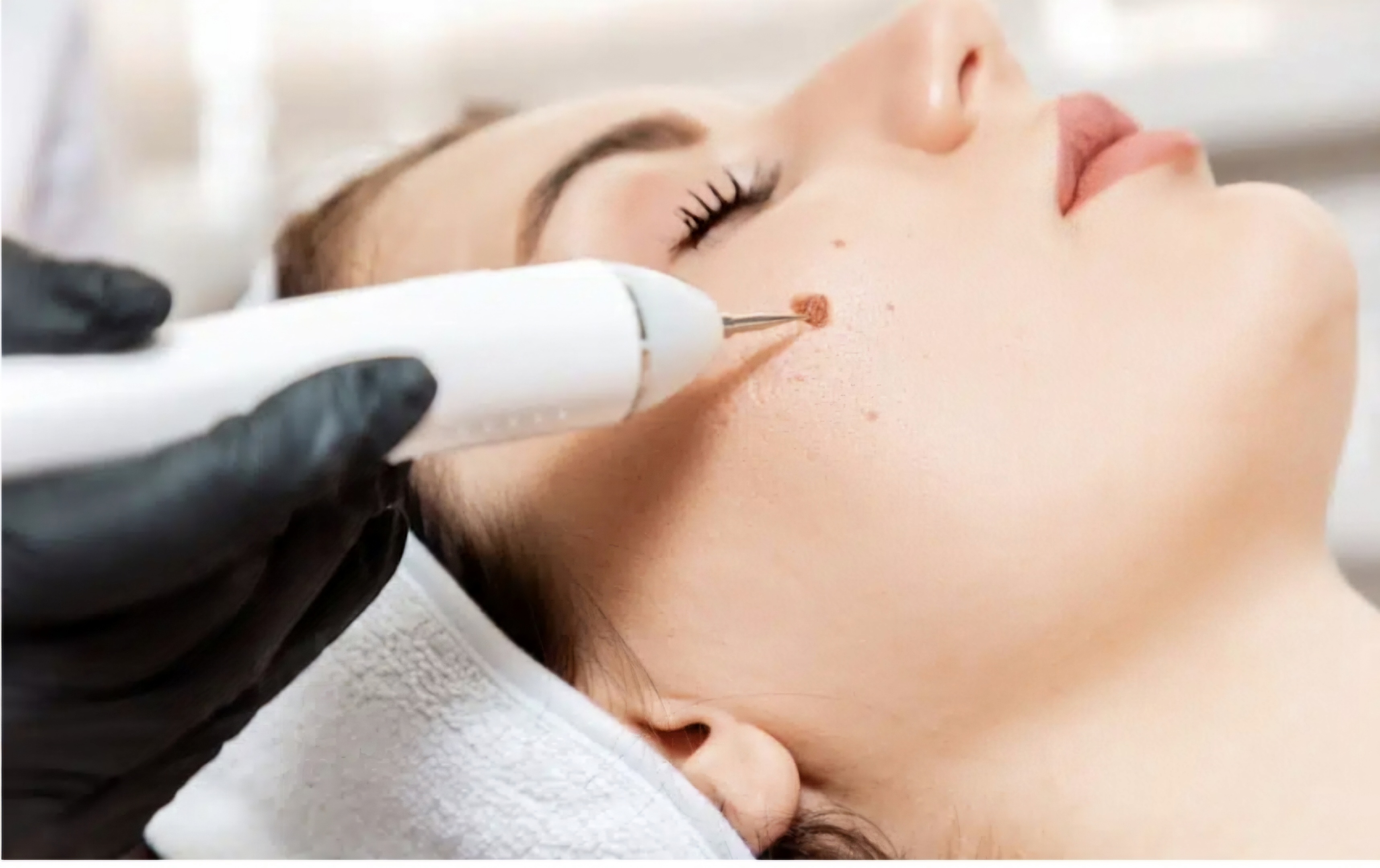 Abonnement behandeling A