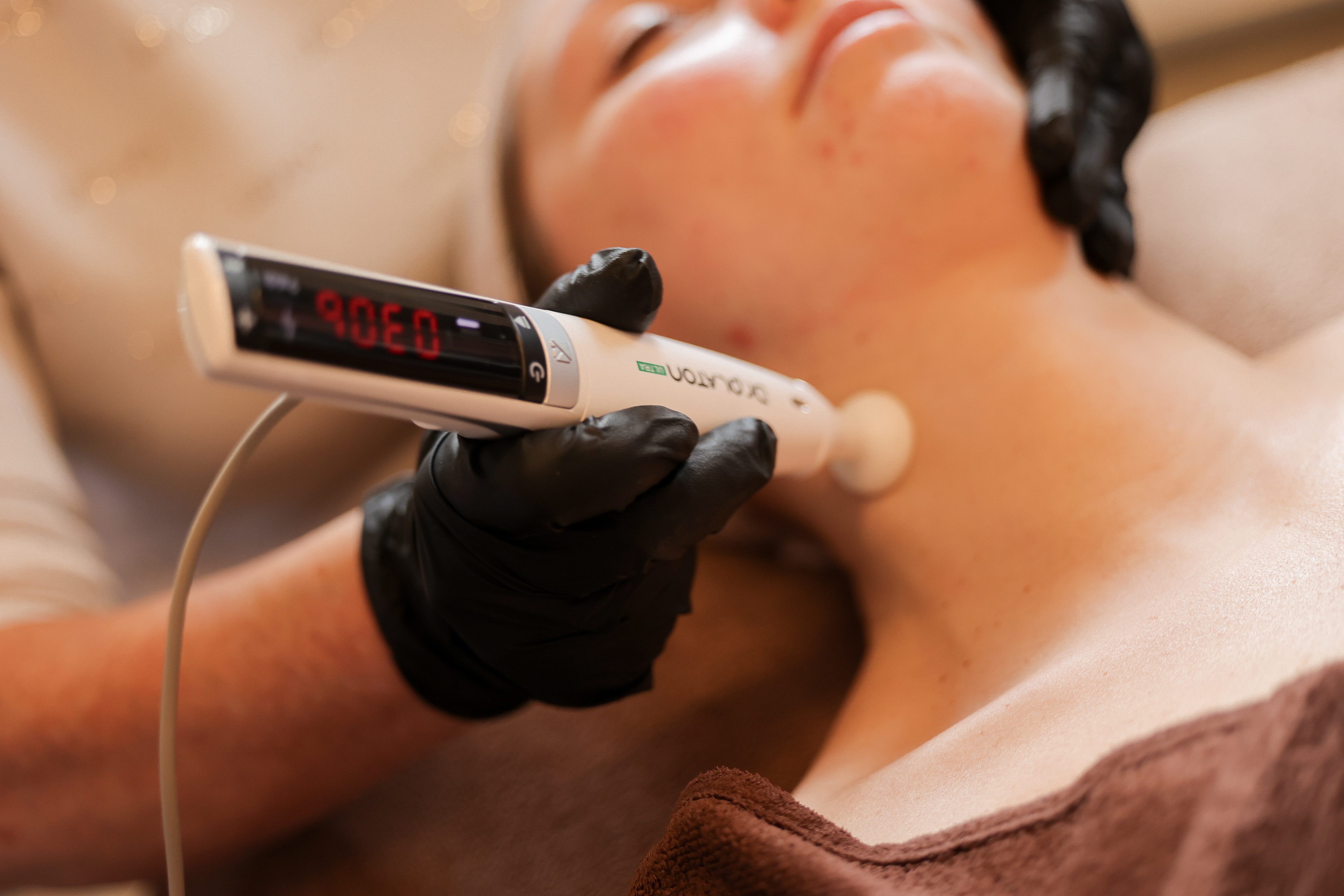 Abonnement behandeling A