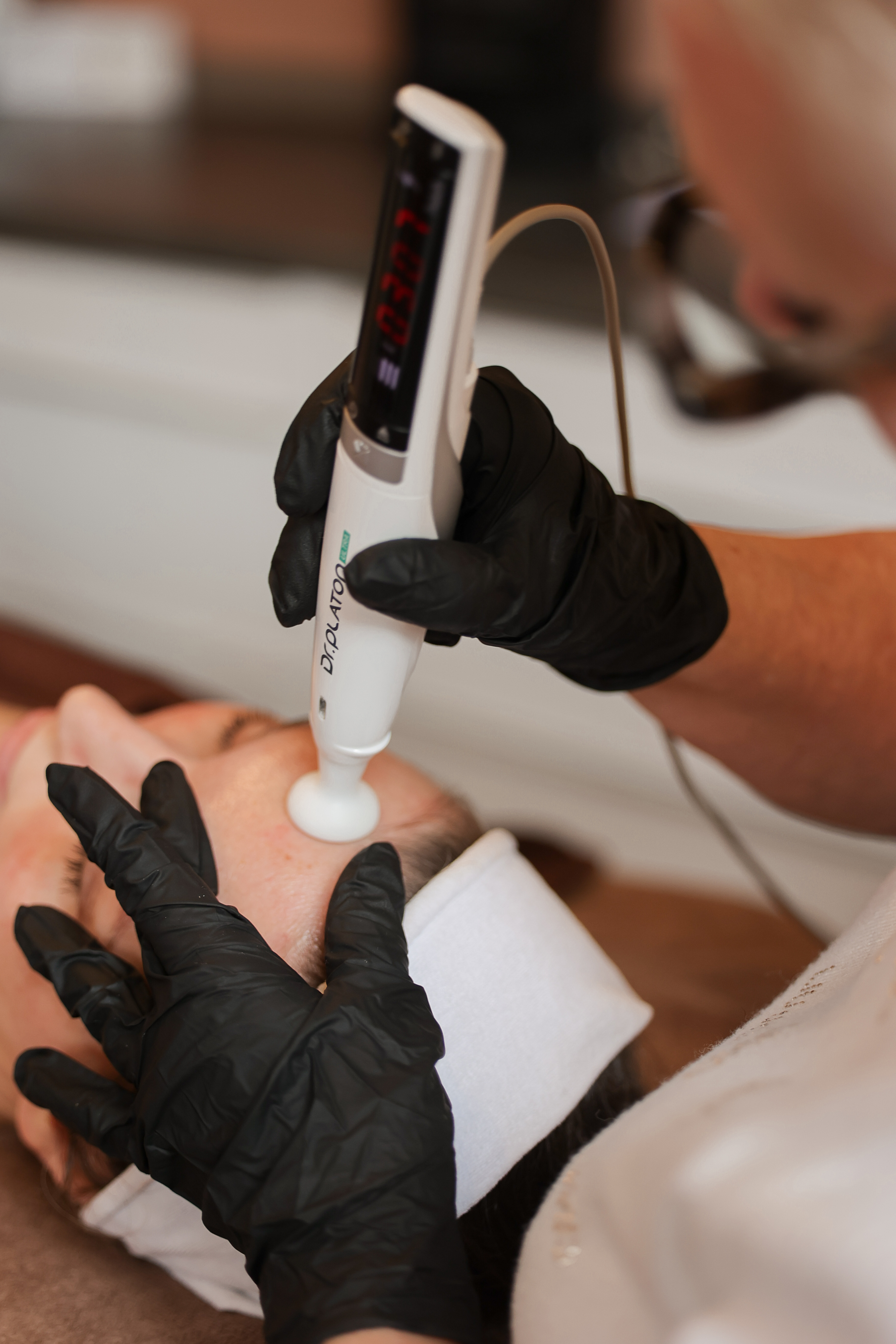 Abonnement behandeling A